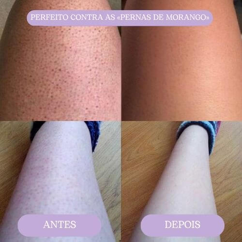 Goma depilatória ORYVIO SmoothTouch™ - Uma pele suave em segundos, sem lâminas, sem dor.