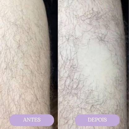 Goma depilatória ORYVIO SmoothTouch™ - Uma pele suave em segundos, sem lâminas, sem dor.