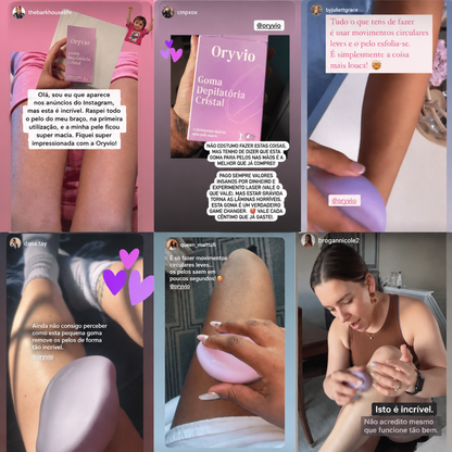 Goma depilatória ORYVIO SmoothTouch™ - Uma pele suave em segundos, sem lâminas, sem dor.